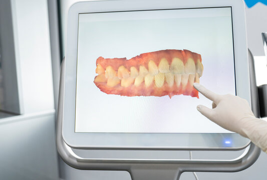 Dentist pointing on scanned image of teeth on monitor screen at medical clinic