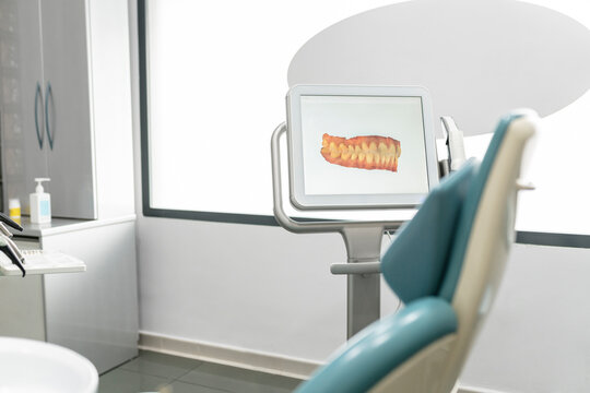 Scanned image of teeth on monitor screen at modern dental clinic