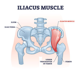 Iliacus muscle with hip or groin muscular and skeletal anatomy outline diagram. Labeled educational scheme with human lesser trochanter of femur and iliac fossa bones location vector illustration. - obrazy, fototapety, plakaty