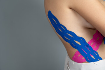  Physiotherapy treatment of scoliosis with kinesio tapes. Female back with colored tapes on gray...