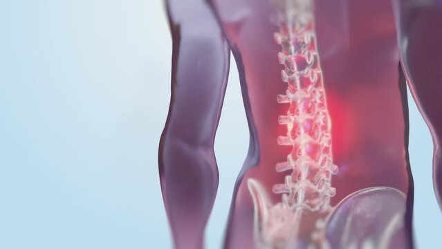 VFX Back Pain Virtual Reality Presentation Render. Animated Person Experiencing Discomfort in a Result of Spine Trauma or Arthritis. Schematic Medical Visualization.