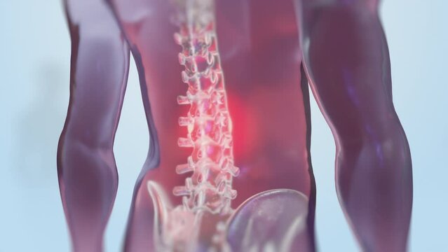 VFX Back Pain Virtual Reality Presentation Render. Animated Person Experiencing Discomfort in a Result of Spine Trauma or Arthritis. Schematic Medical Visualization.