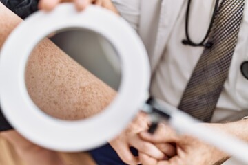 Middle age grey-haired man examining skin freckles arm using loupe at dermatology clinic