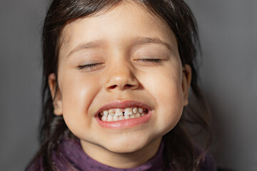 The child shows teeth with hypoplasia. Pediatric dentistry and periodontology, bite correction....