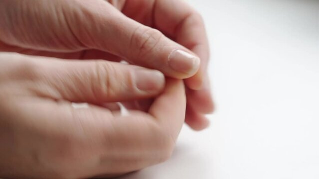 Close up of brittle nails on woman hand. White background. Brocken and dry fingernail. Avitaminosis and micro elements deficits 