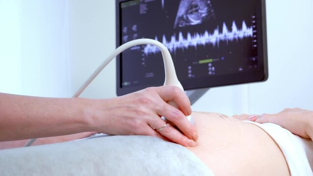 In the Hospital, Close-up Shot of the Doctor does Ultrasound . Sonogram Procedure to a Pregnant Woman.