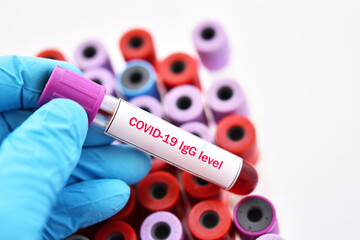 Fototapeta premium COVID-19 IgG level test, blood sample tube for COVID-19 antibody level test, after vaccination