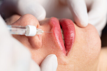 Young lady getting injections for bigger, fuller lips. The woman in the beauty salon. Plastic...