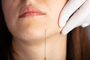 Injection to the face in the chin area. aesthetics, medicine concept. youth injections.
