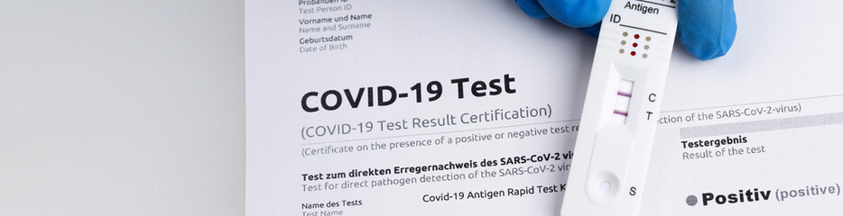 Positive test result by using rapid test device for COVID-19.