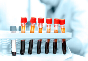 Blood samples in test tubes. Work in the laboratory.