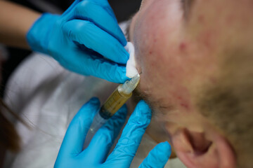 Injection at spa salon. Doctor hands in gloves. Closeup. Pretty male patient. Beauty treatment....