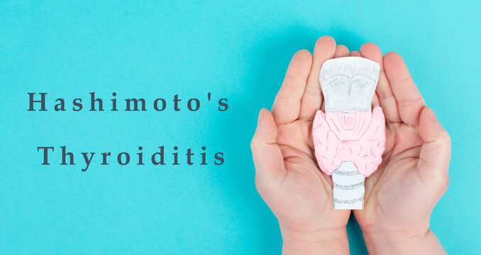 Hashimoto's thyroiditis, chronic lymphocytic disease, holding a thyroid organ, autoimmune symptoms, inflammation throat, health care