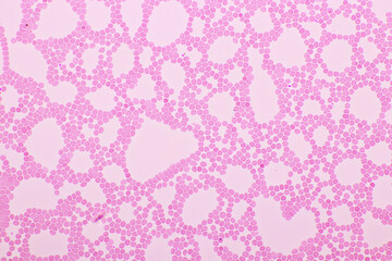 Red blood cells in blood smear, Wright-Giemsa stain, analyze by microscope, 40x