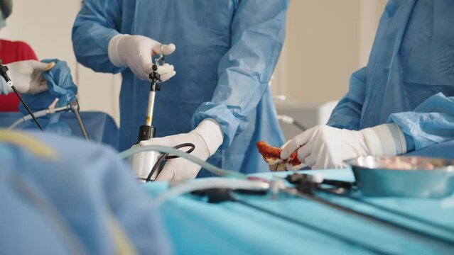 Surgeons team during process operation uterus removal with surgical laparoscopy instruments. Gynecology. Endoscopic surgery to remove the uterus.