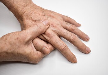 Hands of Asian elder man. Concept of hand pain, arthritis and finger problems.
