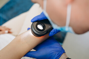 Male doctor wearing a white shirt removing moles on a patient's hand with a special device