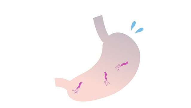 ピロリ菌　胃　イメージアニメーション動画（ループ可）