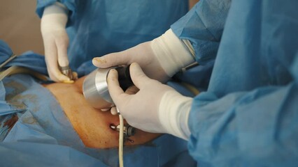 Instruments for laparoscopic surgery at work. Process of surgery operation using laparoscopic equipment. Operating room with surgery equipment