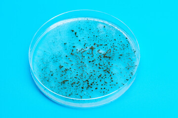 Petri dish with biological samples in a   laboratory of a medical clinic