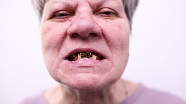 Old Woman Showing Bad Teeth, No Teeth. Gold Teeth, Close-up