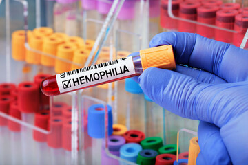 Blood sample with positive diagnosis of Hemophilia. Doctor holding Blood tube positive analysis to Haemophilia