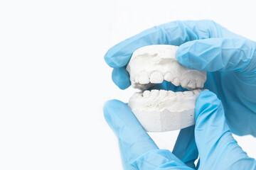 Orthodontist's hand, covered in a blue medical glove holding a dental mold of the lower jaw. The...