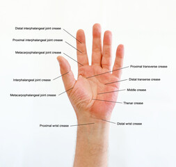 Diagram of Hand lines and flexion creases on the right palm with the wrist in sight flexion of palm Surface for medical use.