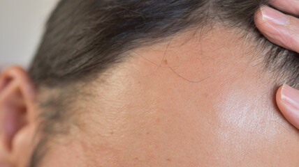 Obraz premium 前頭の髪の毛が薄くなってきている中年男性