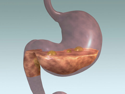 Close-up of a human stomach