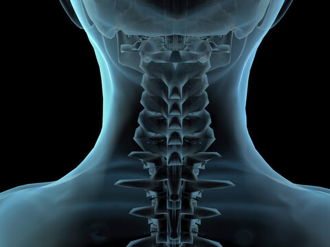 Close-up of an x-ray image of a human neck