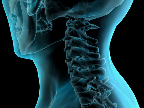 Close-up of an x-ray image of a human neck