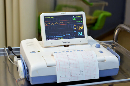 Cairo, Egypt, November 21 2021: Cardiotocography device placed on mother's abdomen recording the fetal heart rate obtained via ultrasound transducer, CTG is used to assess fetal well-being