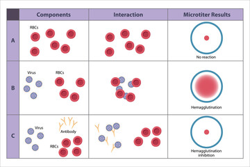 Possible outcomes of hemagglutination test. Agglutination of erythrocytes. The virus-specific antibodies inhibit agglutination