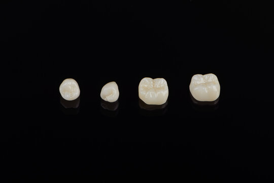 Qualified Anatomic Ceramic And Zirconia Crowns Of Human Teeth Close Up Macro Isolated On Black Background.