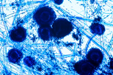 Aspergillus niger and Aspergillus oryzae  (mold) under microscope for Microbiology in Lab.
