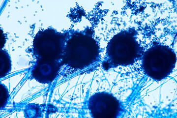 Aspergillus niger and Aspergillus oryzae  (mold) under microscope for Microbiology in Lab.
