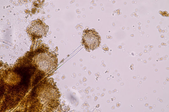 Aspergillus niger and Aspergillus oryzae  (mold) under microscope for Microbiology in Lab.
