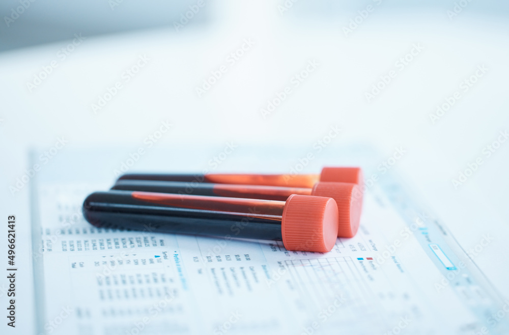 Aufkleber your test results are ready. closeup shot of test tubes and paperwork on a table in a lab.