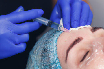 The cosmetologist makes an injection of mesotherapy. Mesotherapy with microneedles for facial skin rejuvenation.
