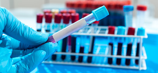 Test tube with empty label  to laboratory research