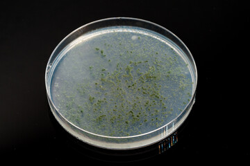 Petri dish with biological samples in a   laboratory of a medical clinic