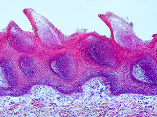 rabbit tongue cross section under the microscope showing filiform papillae, taste buds and...