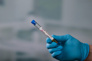 Close up of hands in medical gloves holding a test tube after virus analysis with omicron result markers
