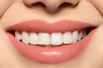 Close up shining orthodontic white female smile, caucasian woman with healthy clean teeth. Smiling mouth with lipgloss balm on lips, natural makeup. Dentistry, dental health, teeth whitening concept.
