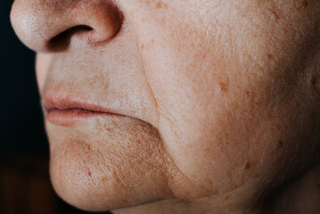 Wrinkled skin, nose and mouth of a mature caucasian woman, moles, real person. Side view, close-up, selective focus