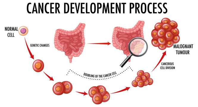 Diagram showing normal and cancer cells in human