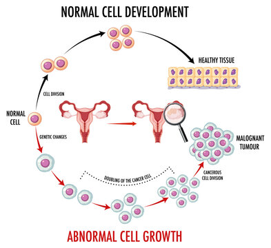 Diagram showing normal and cancer cells