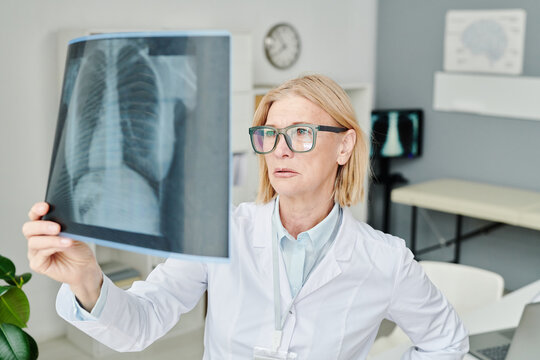 Mature experienced radiologist in whitecoat looking at rontgen of lungs while trying to establish exact diagnosis of patient