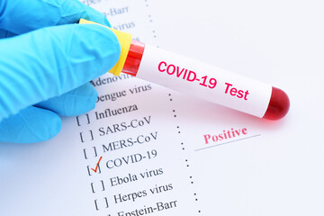 Fototapeta premium Blood sample tube for COVID-19 test with positive report form